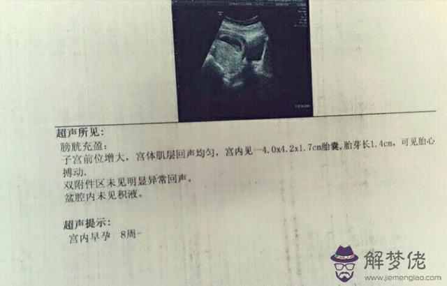 1、懷女孩都有哪些明顯癥狀:最準的懷女孩特征是什麼？