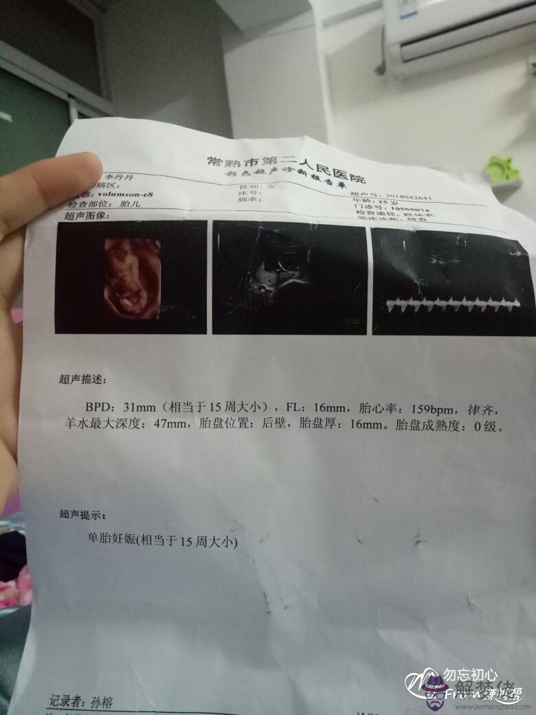 2、懷孕一周內有啥癥狀:懷孕之后上出現哪些特征說明是寶寶在求救？