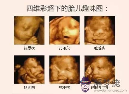 2、女胎兒四維彩超圖片:四維彩超男女圖區別