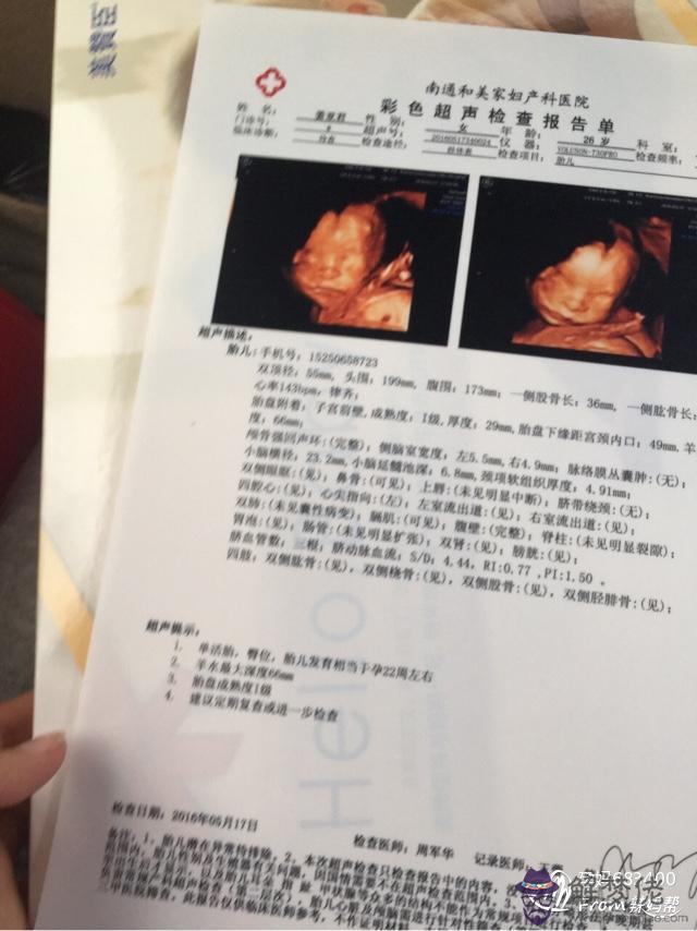 3、女胎兒四維彩超圖片:七個月四維彩超圖片，看下是男孩女孩？