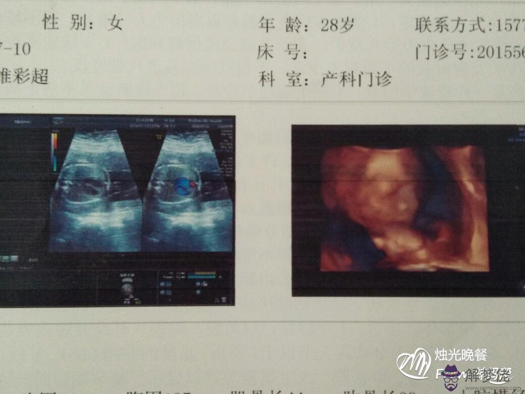 2、懷女兒的初期癥狀:懷上女孩的癥狀要怎麼判斷呢？