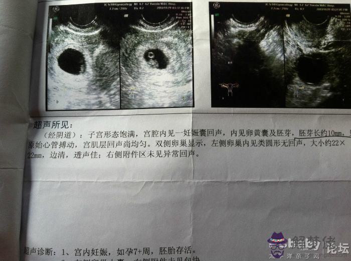 1、怎麼樣才能懷女寶寶的幾率大:如何增加懷女寶寶的幾率