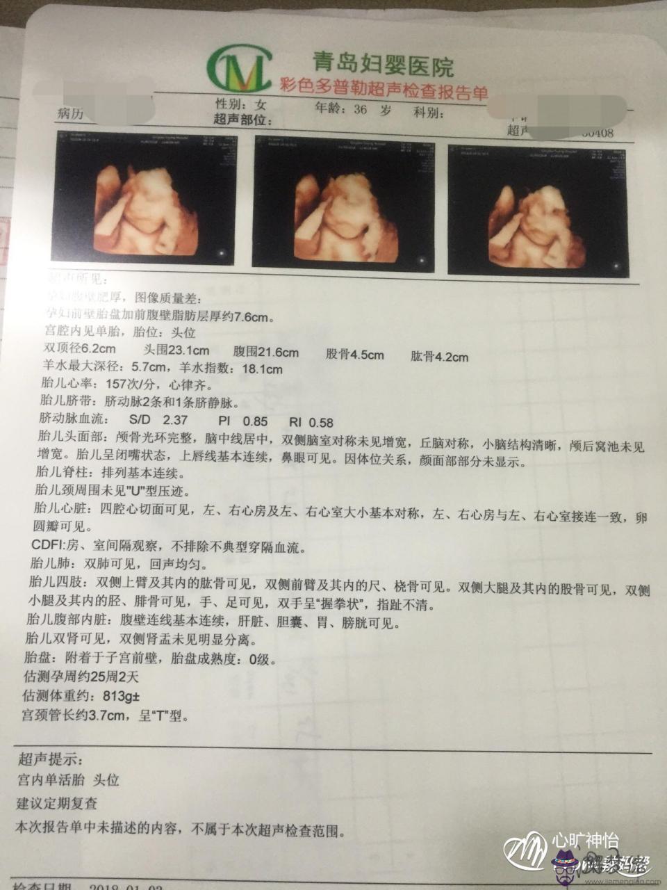 1、生女孩的四維彩超:四維男女寶寶區分圖，教大家怎麼通過四維照片看寶寶性