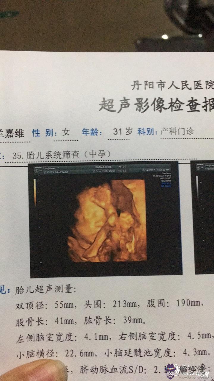 2、生女孩的四維彩超:胎兒的四維照片跟寶寶的實際相貌會有多大的差別？