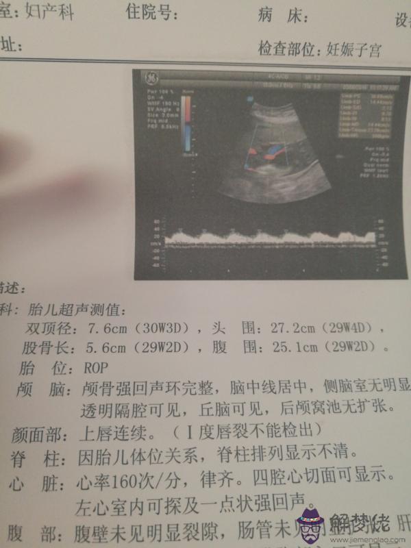 1、71年生男和92女能婚配嗎:71年男豬和80年的女猴是否婚配？