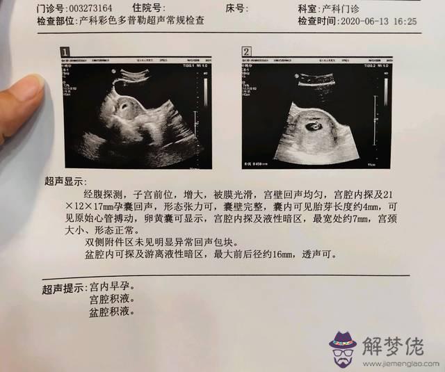 1、的胎兒求人:年懷孕50天查血能查出男孩女孩嗎？