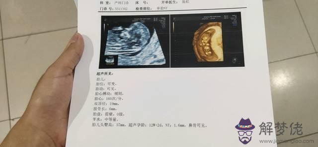 頭胎頭旋看下胎男女準嗎：怎麼知道下一胎生男還是生女