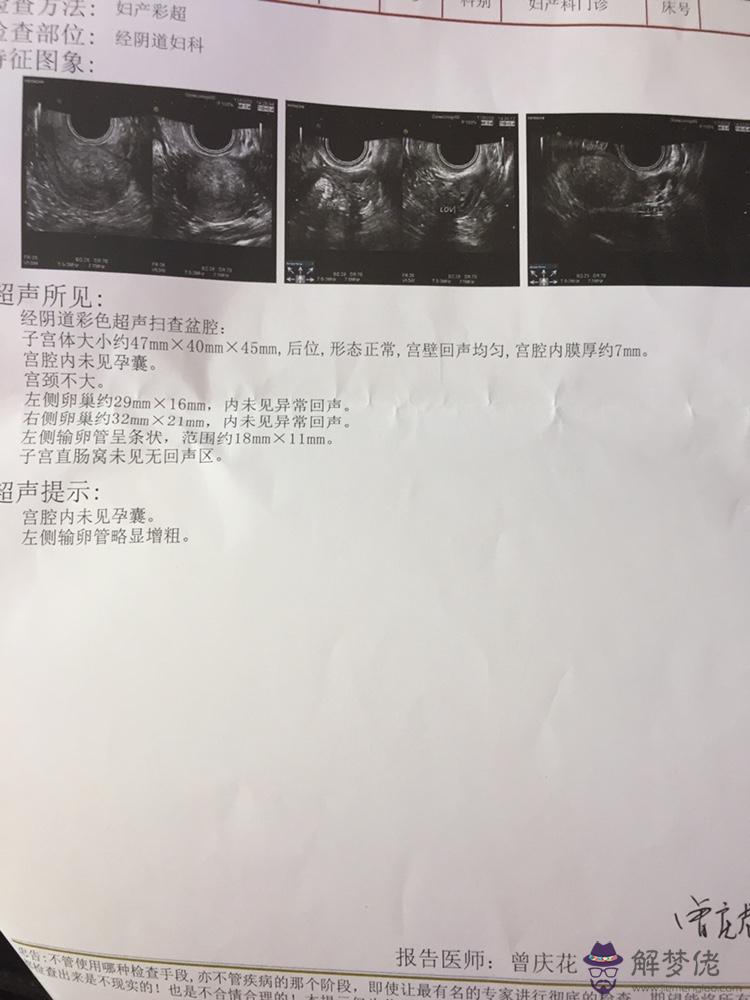 準確查出日的方法：根據早期孕囊大小可以大致的推算出實際的天數嗎？