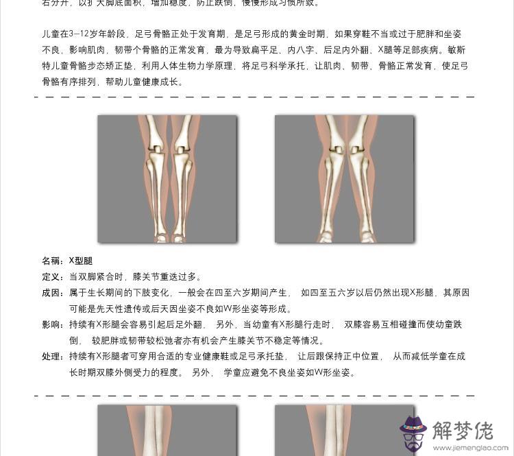 內八字命
