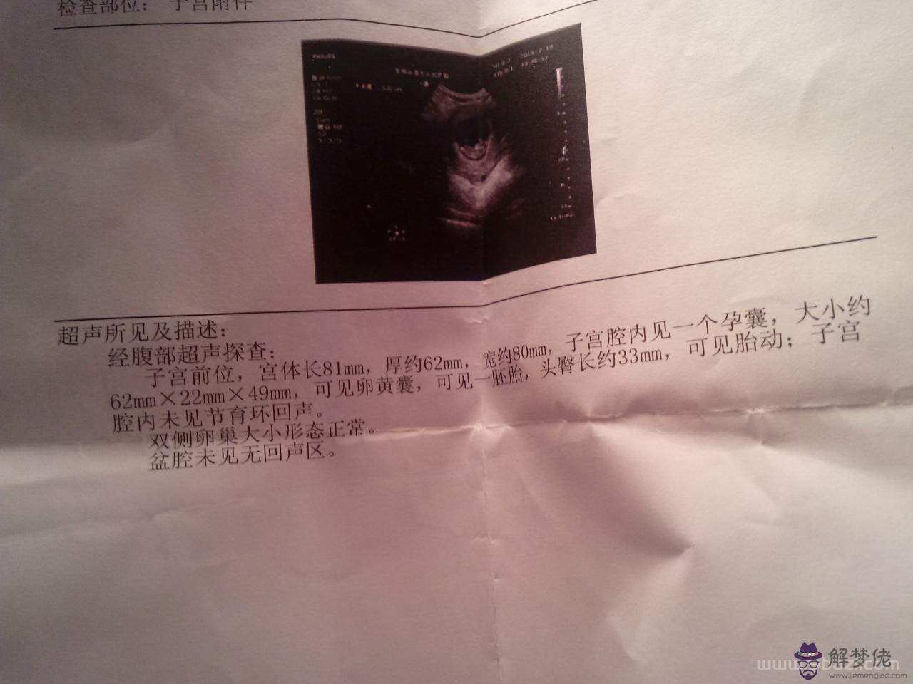 懷孕10幾天能打掉嗎，懷孕20多天可以做流產嗎