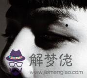 臉上、手上的痣看你命運【圖解】 臉上、手上的痣看你命運「圖解」