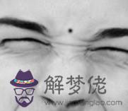 臉上、手上的痣看你命運【圖解】 臉上、手上的痣看你命運「圖解」