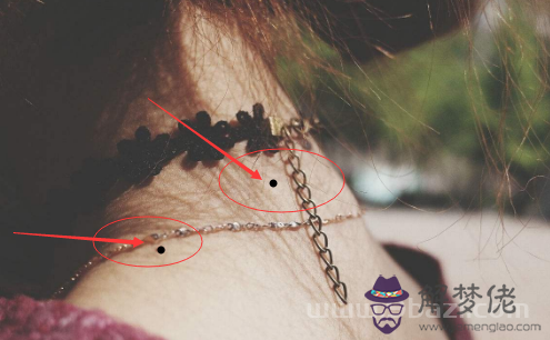 脖子上有痣好嗎 脖子上有痣好嗎
