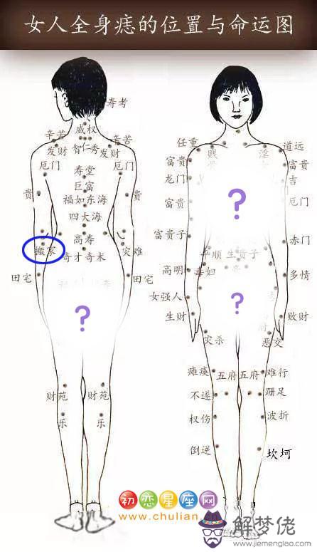 搬家痣 搬家痣