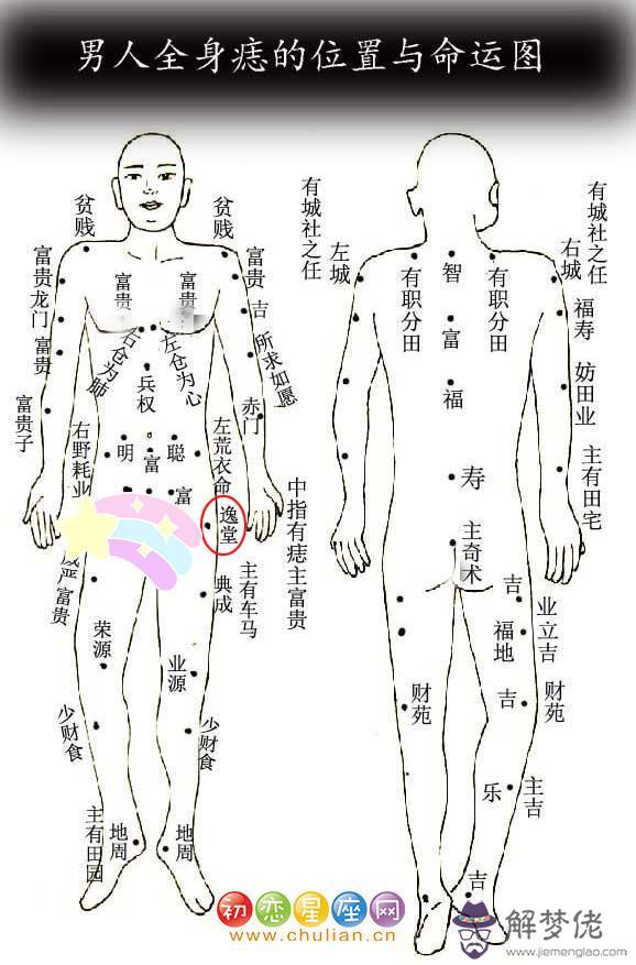 逸堂痣