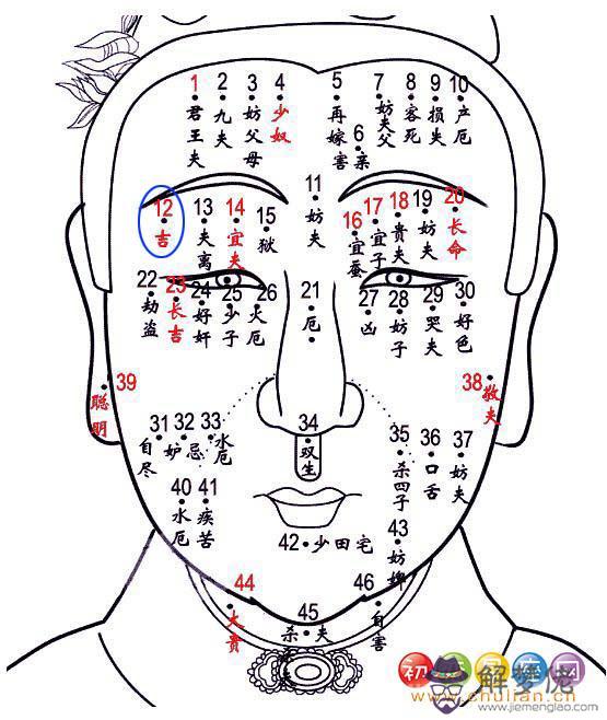 吉痣