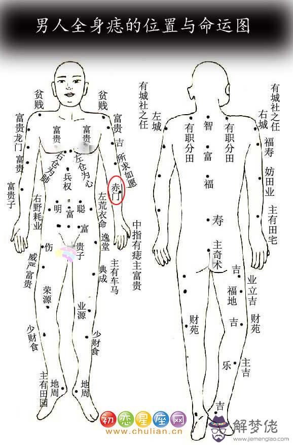 赤門痣