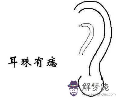 耳朵痣的位置與命運圖解大全