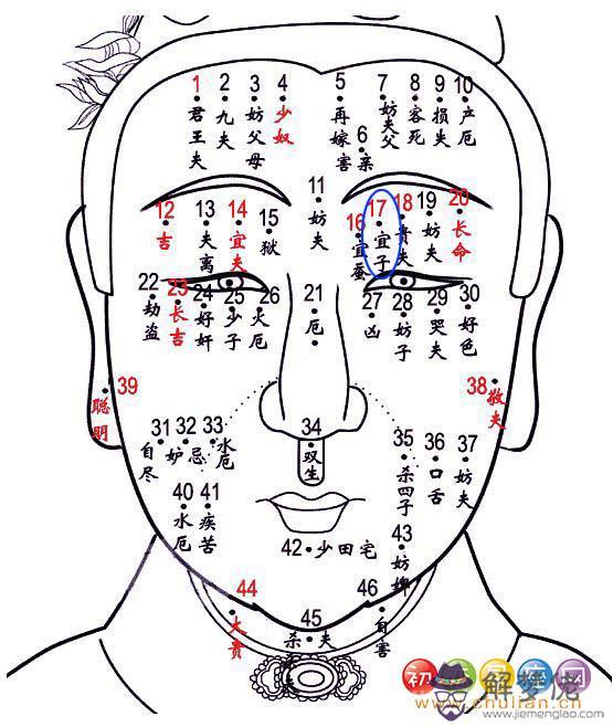 宜子痣