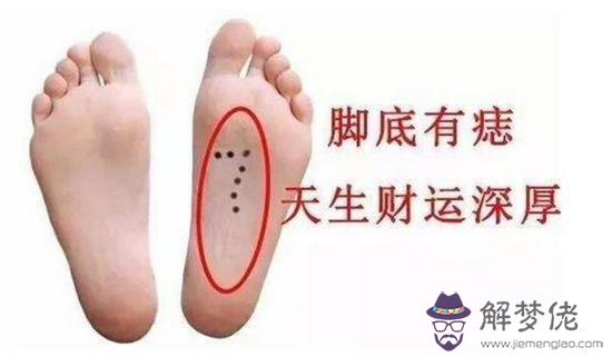 腳下有痣代表什麼，男人女人腳底有痣詳解