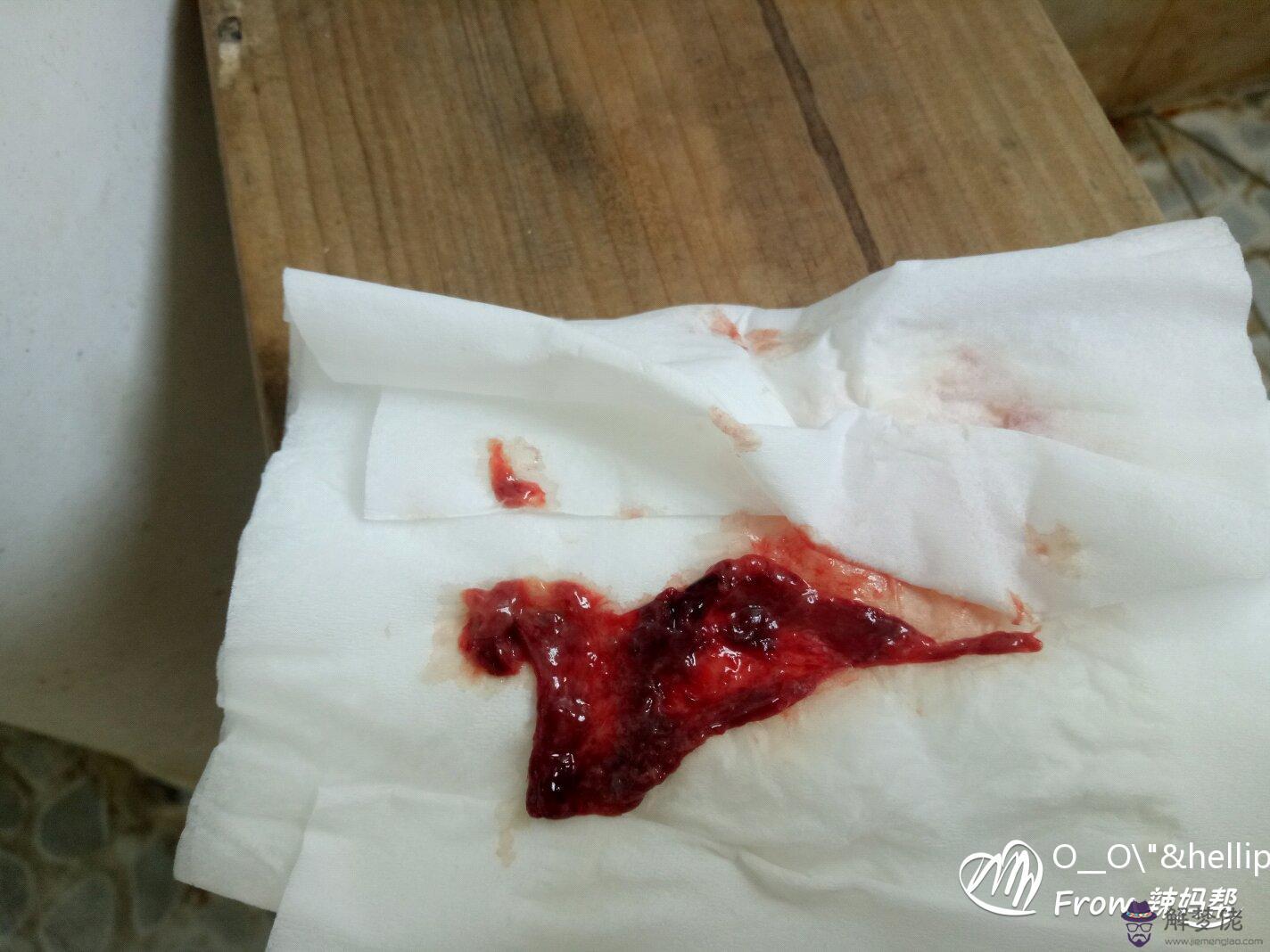 孕早期最快判斷宮內孕:宮內孕懷孕有什麼癥狀