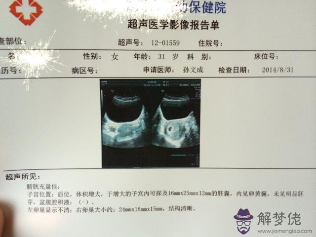 孕早期最快判斷宮內孕:宮外孕的癥狀有哪些?