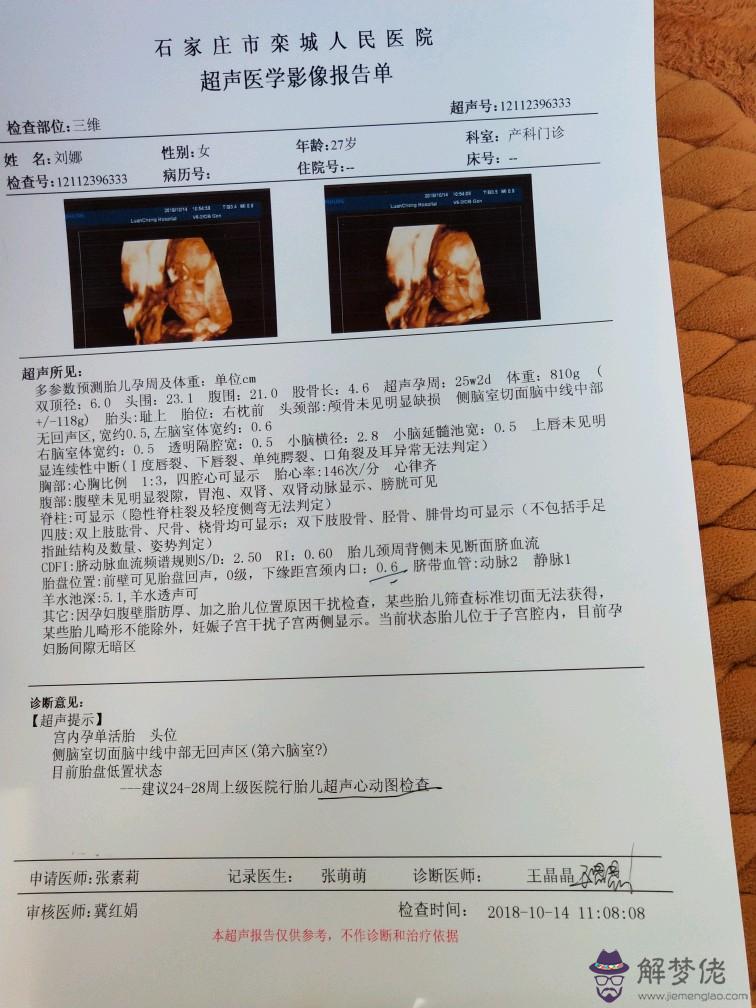 上一胎預知下一胎男女：夢幻誅仙手游小兜妹怎麼樣