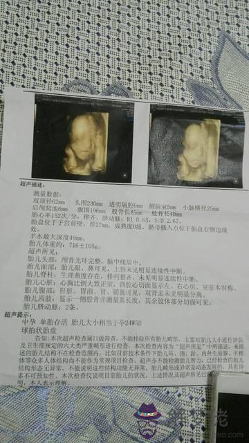 生兒子一般的孕期征兆:生男孩的癥狀