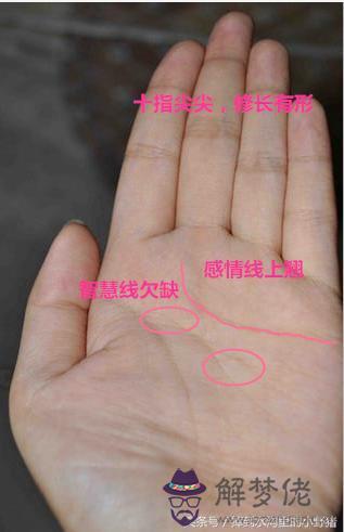 手指各種受傷運勢