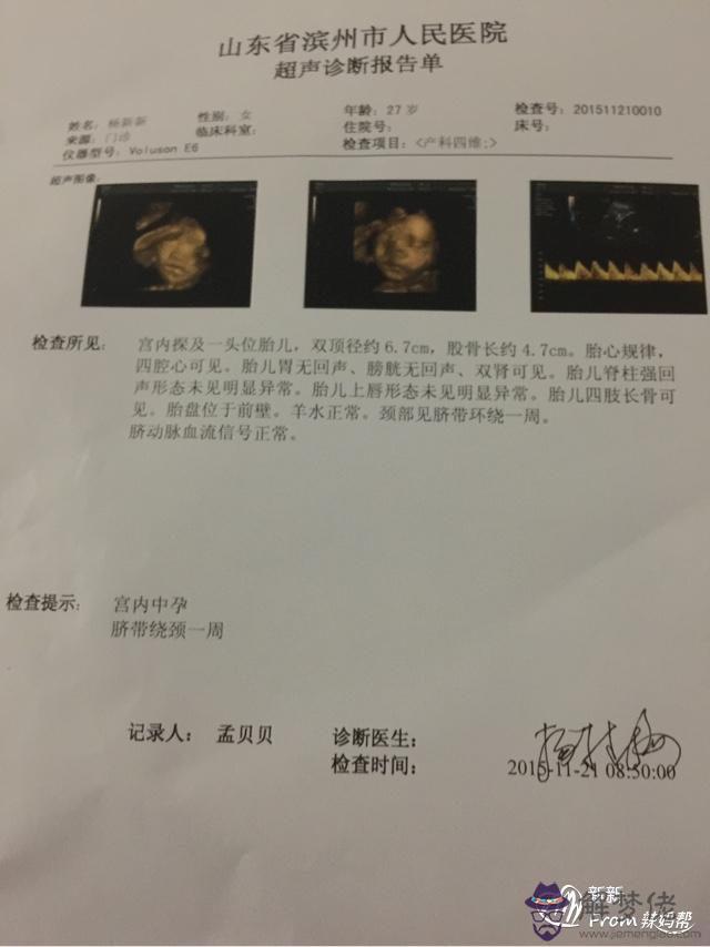 3、懷男孩40天最準的感受:說說懷男孩子會有什麼不一樣的感覺？