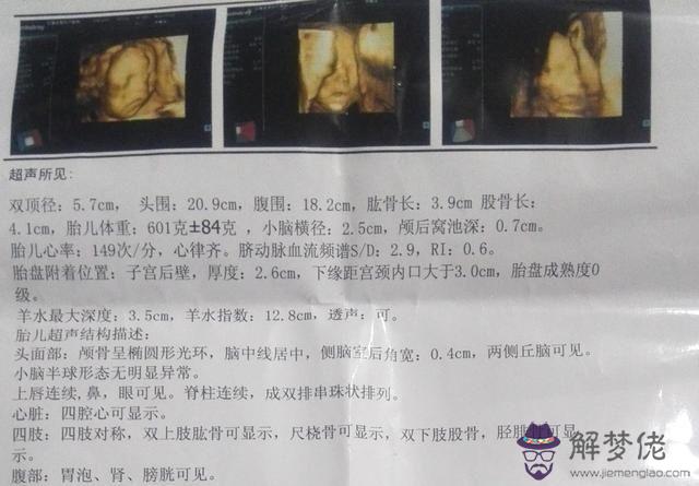 1、五個月最準懷男孩征兆:孕期征兆暗示你生男孩!
