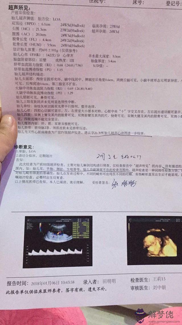 2、五個月最準懷男孩征兆:懷男孩的征兆