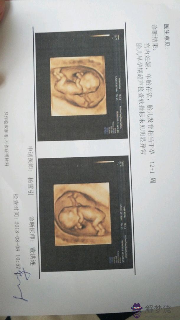2、懷男孩有什麼特征最準:懷男孩的特征都有哪些？