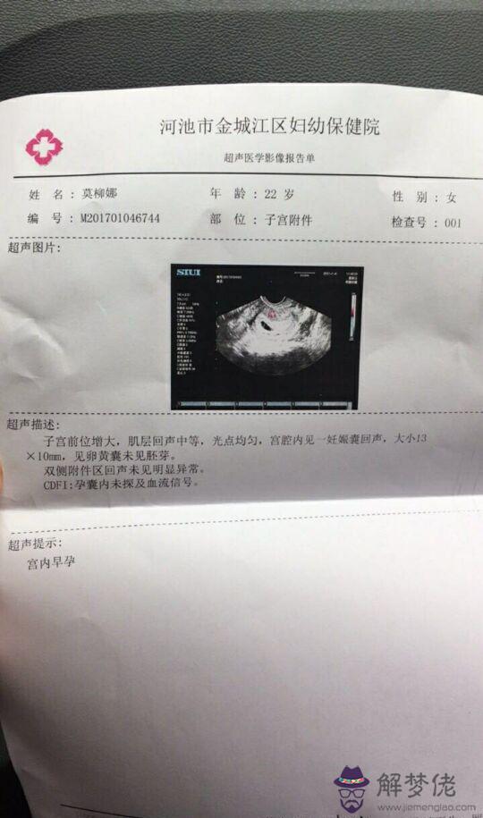 3、九個最準懷男孩征兆:懷兒子的特征最準的