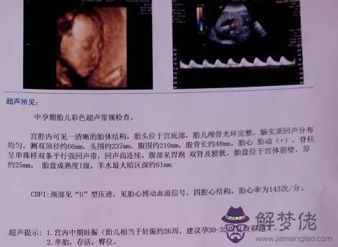 生男孩的三個最佳時間點：什麼時間段懷上男孩最合適