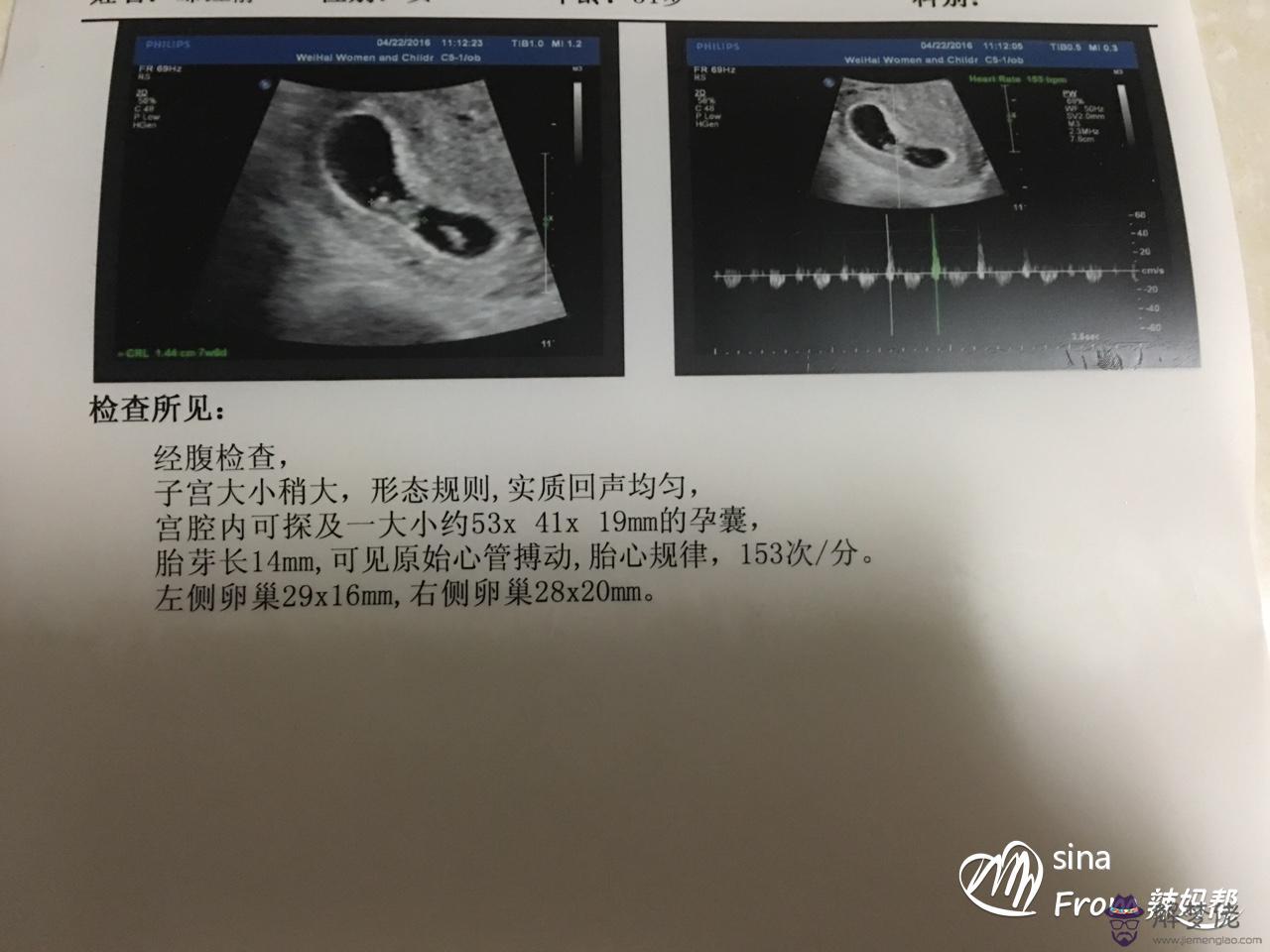 懷孕初期看男女小技巧：懷男孩子的時候會有什麼感覺？