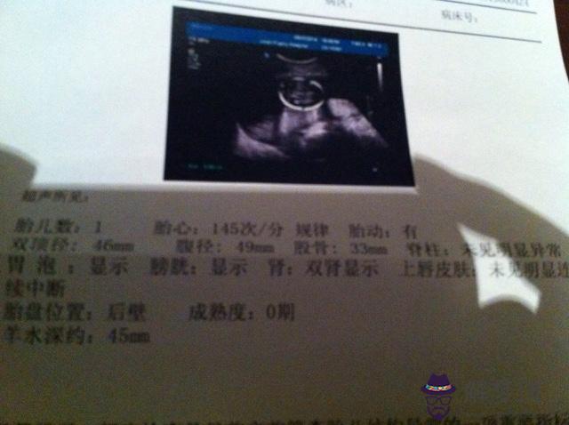 懷孕幾個月能看出男女孩：彩超男孩是不是亮點