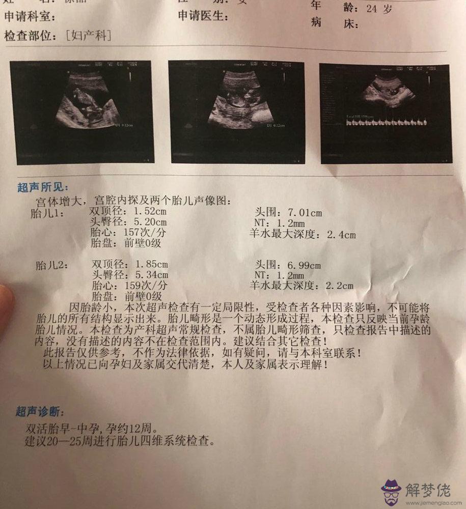 懷孕怎麼看是男是女計算公式：如何算生男生女最準確
