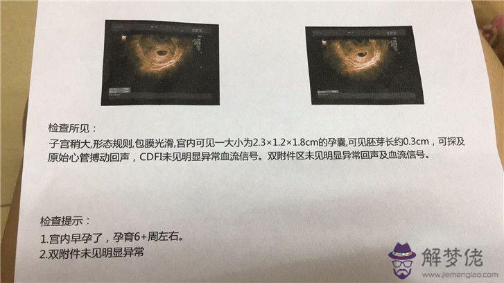 懷孕2個月最準看男女驗血：急！抽血能化驗出懷男孩女孩嗎？