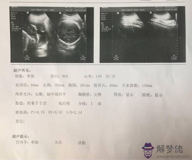 懷孕六個月男女區別圖：懷男孩的征兆