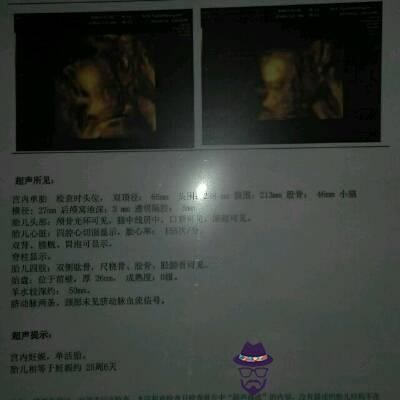 懷男孩的早期癥狀有哪些：懷男孩有什麼特征和感覺