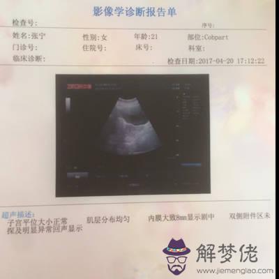 單看胎囊形狀我家是明星的茄子形狀的、沒有數據、能判斷是閨女還是兒子嗎
