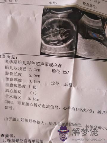 懷孕四個月男女分辨圖生買生女表：有哪些征兆預示著會生女兒？
