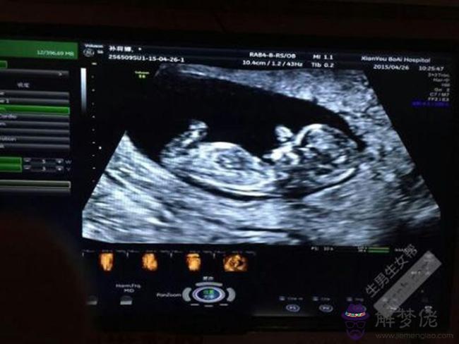 懷孕2個月最準看男女b超：2個月看男女準確嗎