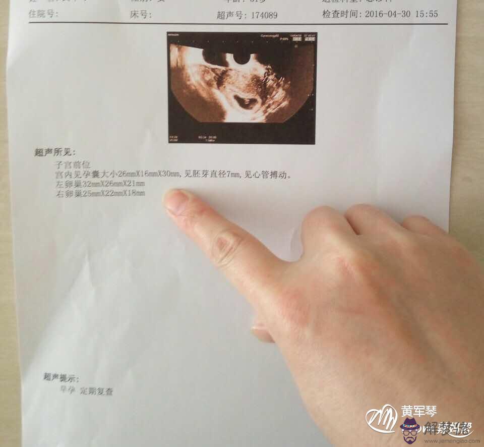 什麼時候的孕囊看男女比較準：看早期孕囊形狀看男女準嗎?