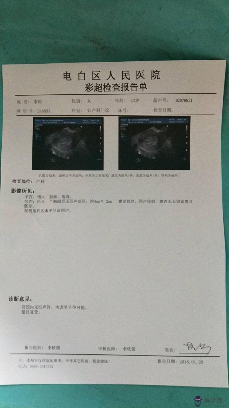 已生男孩孕囊圖片陰超：懷孕11周，孕囊是男是女