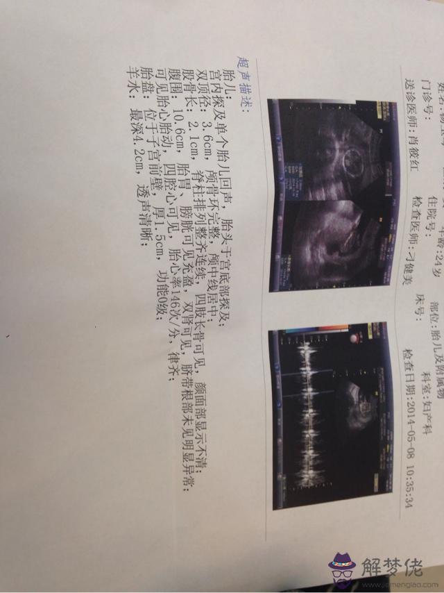 一胎男孩二胎女孩癥狀:懷第一胎反應晨吐第二胎沒反應會是女孩還是男孩