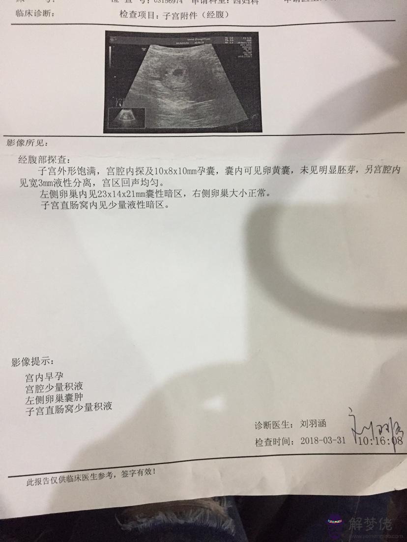 一胎男孩二胎女孩癥狀:一胎男孩二胎女孩好嗎