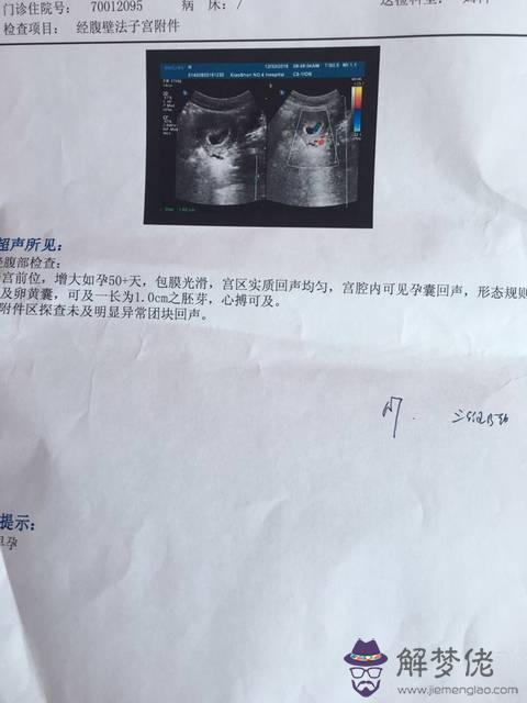 早孕怎麼測男女寶寶最準：怎麼測男女寶寶最準