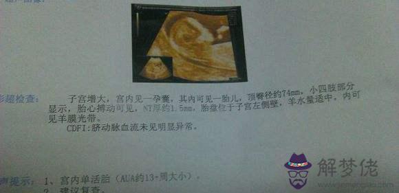 已生男孩孕囊圖片43天：懷孕70多天孕囊應該有多大了
